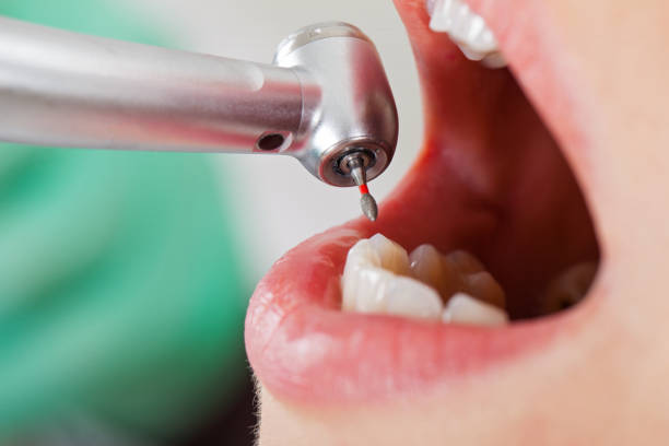 Best Pediatric Emergency Dentist in Surrey, ND
